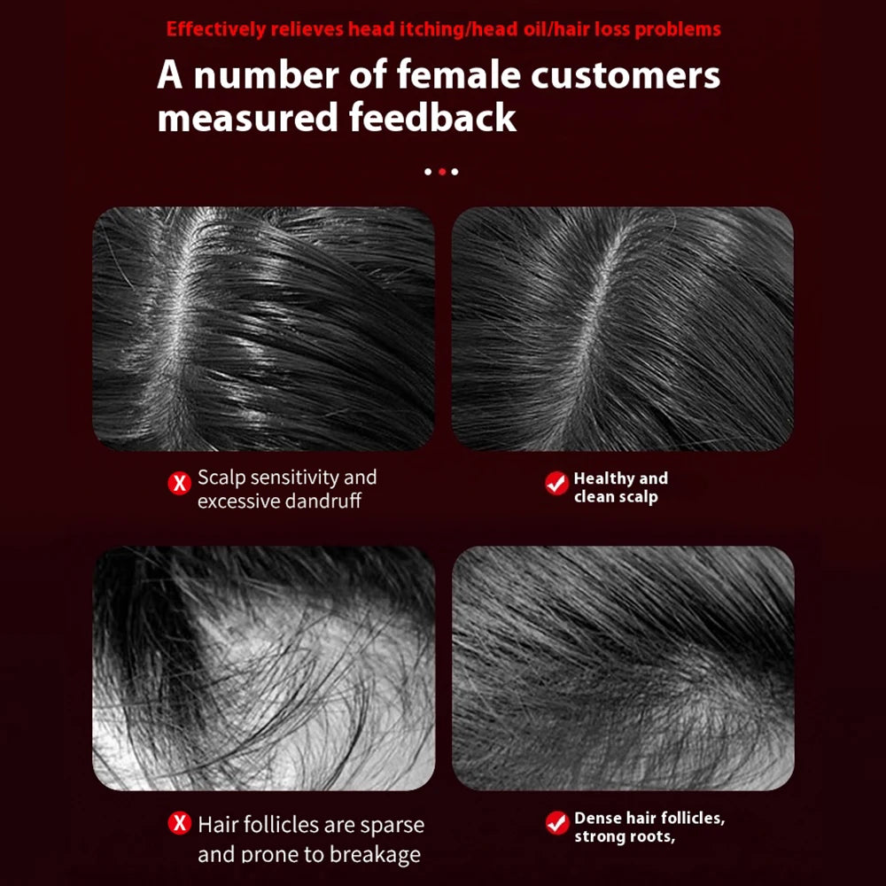 Electric Scalp Massage Comb for Growth Scalp Oil Applicator Hair Care 660nm Red Light Head Massager Improve Hair Loss Brush